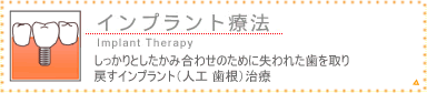 �C���v�����g